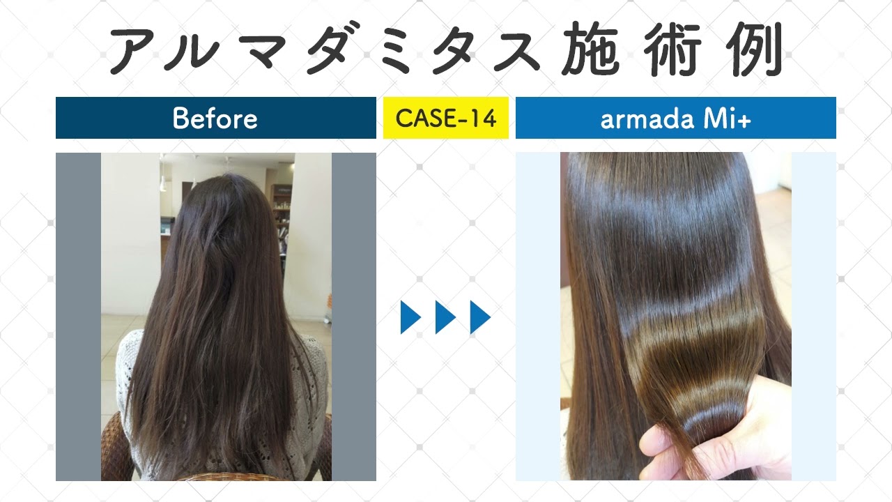 アルマダM301(アルマダミタスMi+)大サイズ(1000ml)(スプレイヤーなし