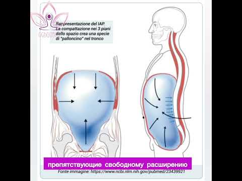 Внутрибрюшное давление (ВБД)