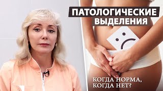 Как отличить нормальные и патологические выделения у женщин?