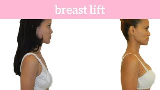 Lose Your Curves After Weight Loss?