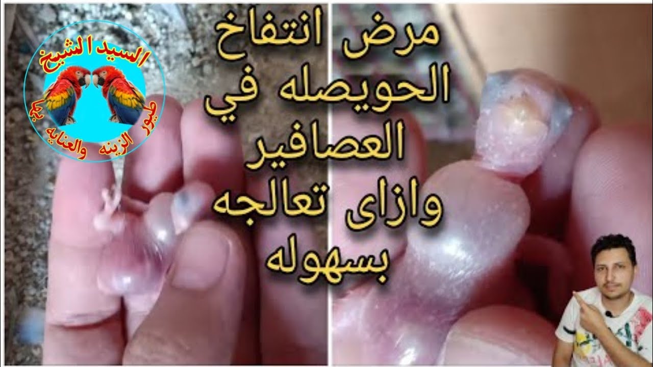 مرض انتفاخ الحويصله في العصافير اسباب وأعراض المرض وطريقة علاج المرض