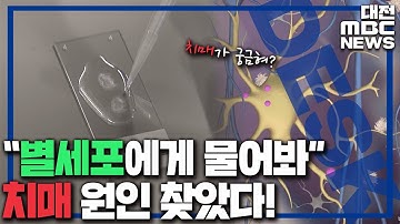 치매 원인 규명 성공 치료제 개발 언제쯤/대전MBC