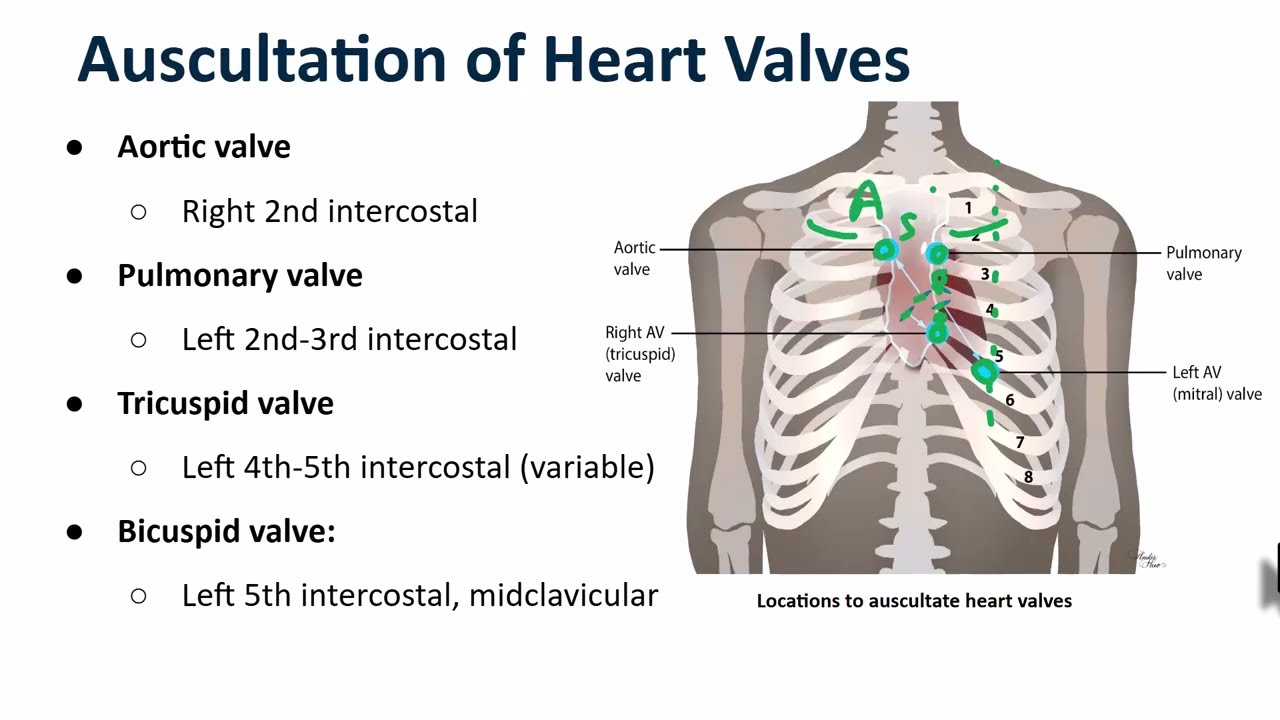 Cardiac Auscultation - YouTube