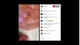Famous YourRage On Instagram Live After Surgery On His Shoulder Profile