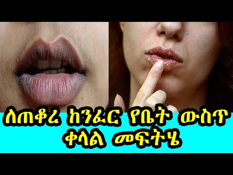 ቪዲዮ: ከንፈር በላይ መስመሮችን የሚሸፍኑባቸው 3 መንገዶች