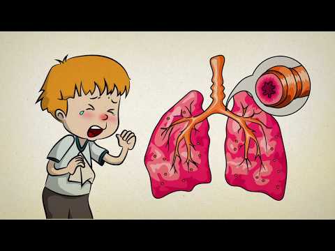 Аллергия у ребенка CosmicHealth for kids