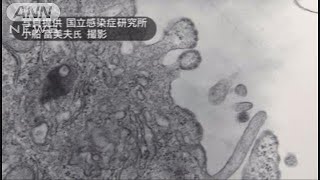 千葉県と川崎市ではしか相次ぐ　搬送の消防隊員も(19/02/26)