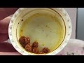 Middle of video