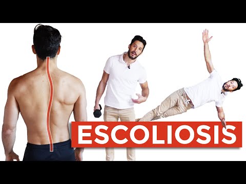 Vídeo: 5 Ejercicios De Escoliosis Principales