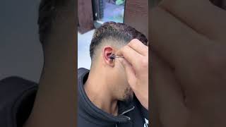 ازالة الحباية المتسلطنة م الودان                                اكسبلور                            سمعها