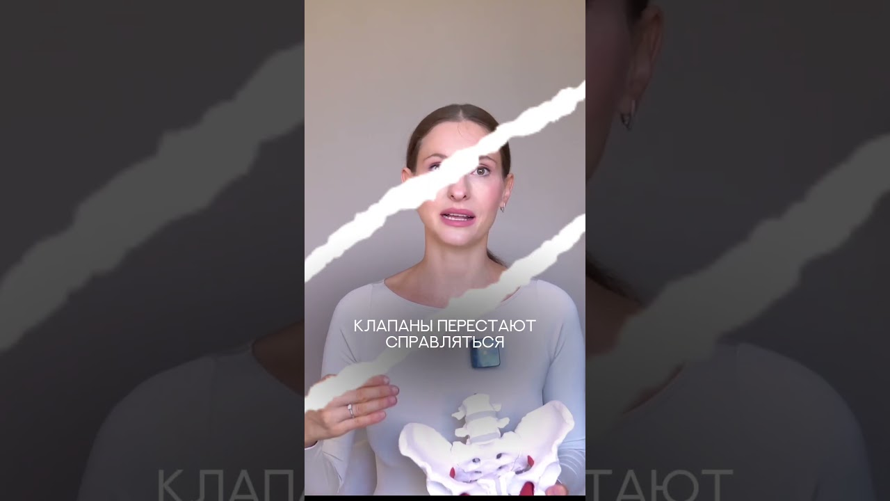 Почему варикоз не проходит?😱