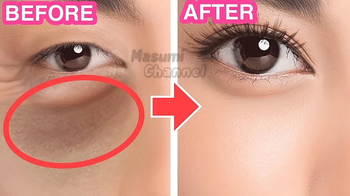 8mins Anti-Aging Eye Lifting Massage For Dark Circles Under Eye, Sunken Eyes, Eye Bags, Bigger Eyes