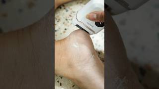 Transform your feet at home🦶 Electric callus remover #azah #callusremoval #callus #footcare