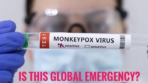 WHO Declares Mpox a Global Health Emergency: WhatYou Need to Know