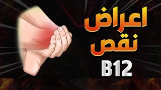 أهم 7 علامات تدل في الغالب على نقص فيتامين B12  في جسمكلا تتجاهلها وتعرف عليها فورا