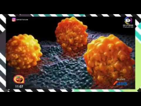 METASTASIS A GANGLIOS LINFATICOS  DR  NIUSVER FONSECA ONCOLOGO DE AMECAE