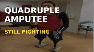 Quadruple Amputee Alex Lewis  Life's Best Years After Tragedy