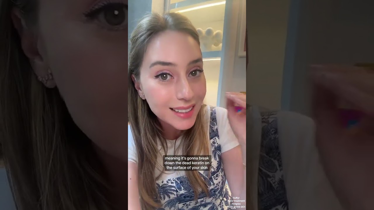 Sulfur Acne Treatment #shorts