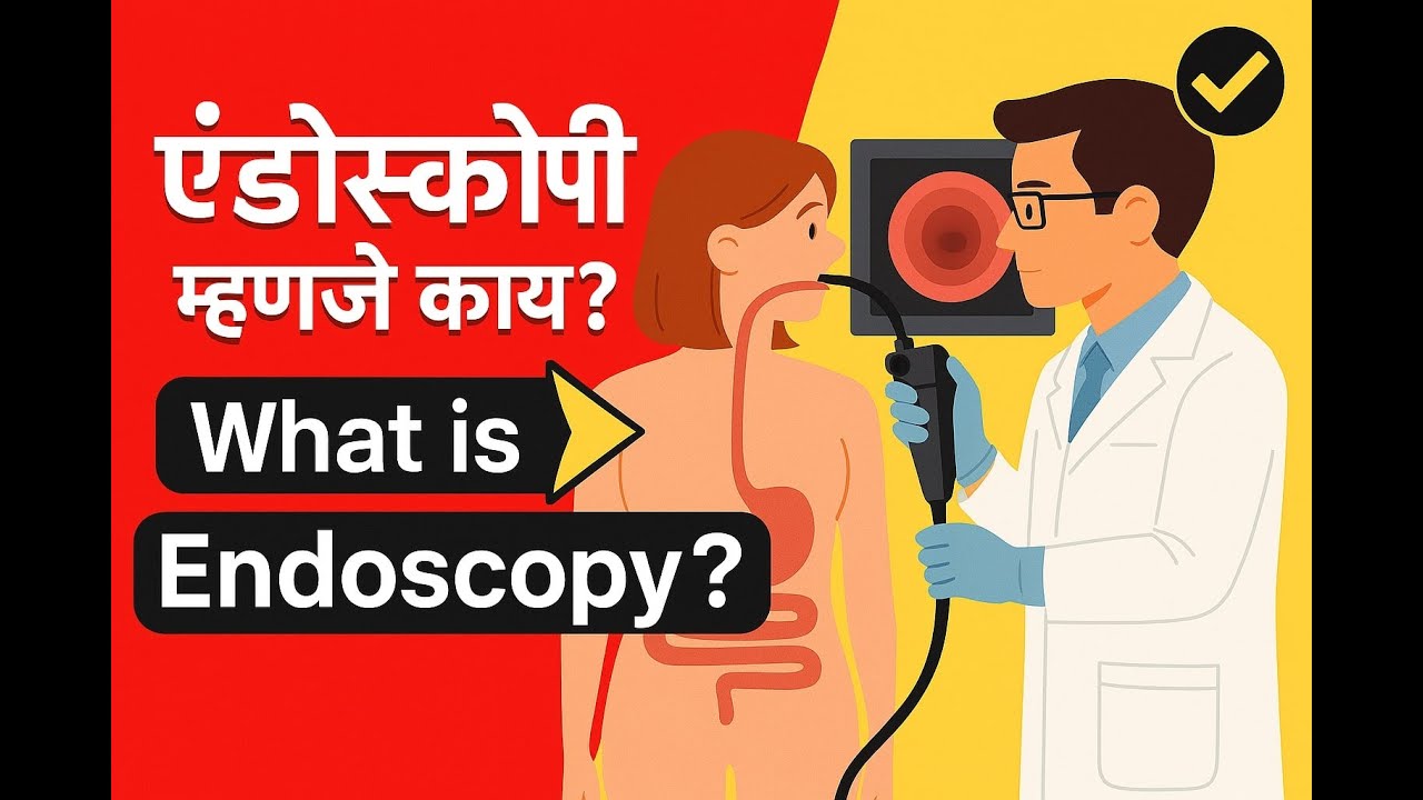 एंडोस्कोपी म्हणजे काय? - डॉ विक्रांत काळे | What is Endoscopy