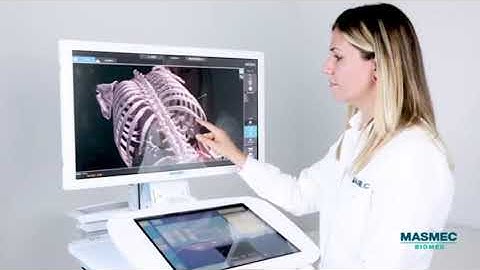 Surgical Navigation System | Trailer | Biomedical Engineers TV |