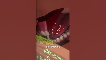 What if a Snake Bites you?  #facts #shorts