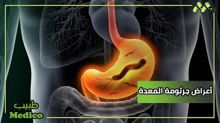أعراض وعلاج جرثومة المعدة مع أ.د. علاء قنديل