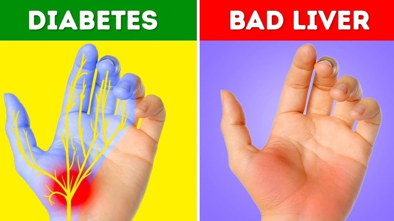 23 THINGS YOUR BODY IS TRYING TO TELL YOU