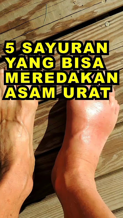 5 Sayuran Yang Bisa Meredakan Asam Urat #ekoazis