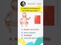 Nursing quiz #norcet #medical #nursingquiz #medicalquiz #nursing #norcetpreparation