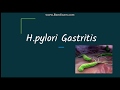 Helicobacter pylori gastritis: Pathogenesis and morphology