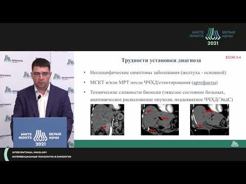 Klatskin tumor combination therapy (Andrey Moiseenko)