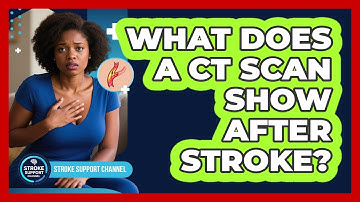 What Does A CT Scan Show After Stroke?