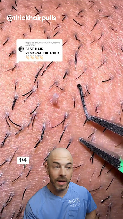Satisfying hair plucking moments you can’t look away from! (credit: @thickhairpulls) #satisfying