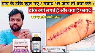 घाव के टांके खुल जाये या टांके पक जाए तो क्या करना चाहिए | wound stitches Treatment /Medical jankari