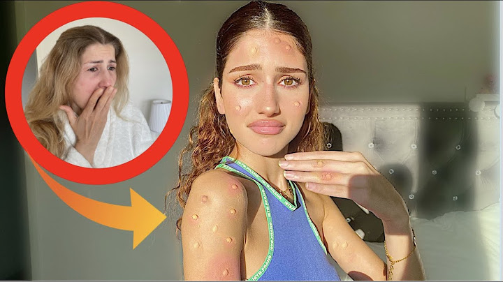 مقلب جدري القرود بماما!!😱 🐒