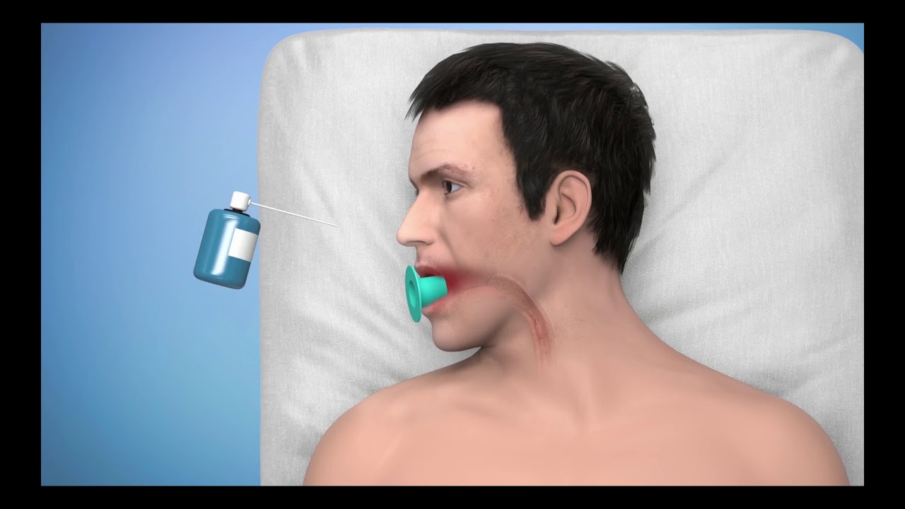 HV Stent Plus animation