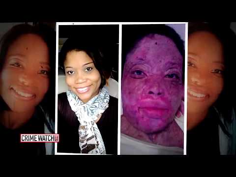 he-disfigured-his-girlfriend-and-called-it-an-accident