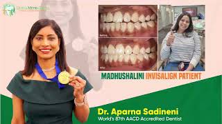 Madhushalini Gets Her Bite Fixed With Clear Invisible Braces Top 1% Invisalign Diamond Provider