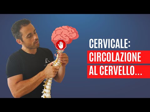 Video: La midriasi può causare emicrania?