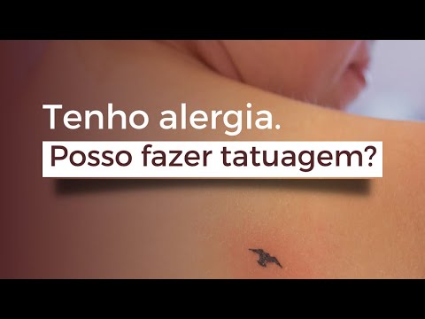 Tenho alergia. Posso