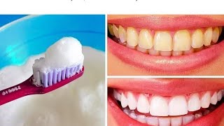 تبييض الاسنان في ثواني التخلص من الجير والقضاء على نزيف اللثة وصفة مجربة مع رزان