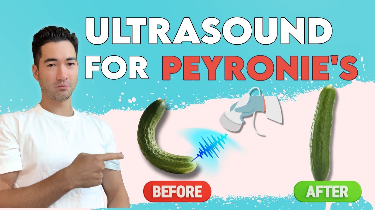 Curved Penis Fix Your Peyronie s Disease With Ultrasound Treatment curved-penis-fix-your-peyronie-s-disease-with-ultrasound-treatment