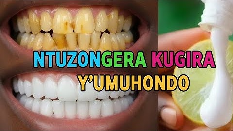 INSHURO IMWE AMENYO AHITA ABA UMWERU UKORESHEJE IRIBANGA  || Teeth Care-Educational Content
