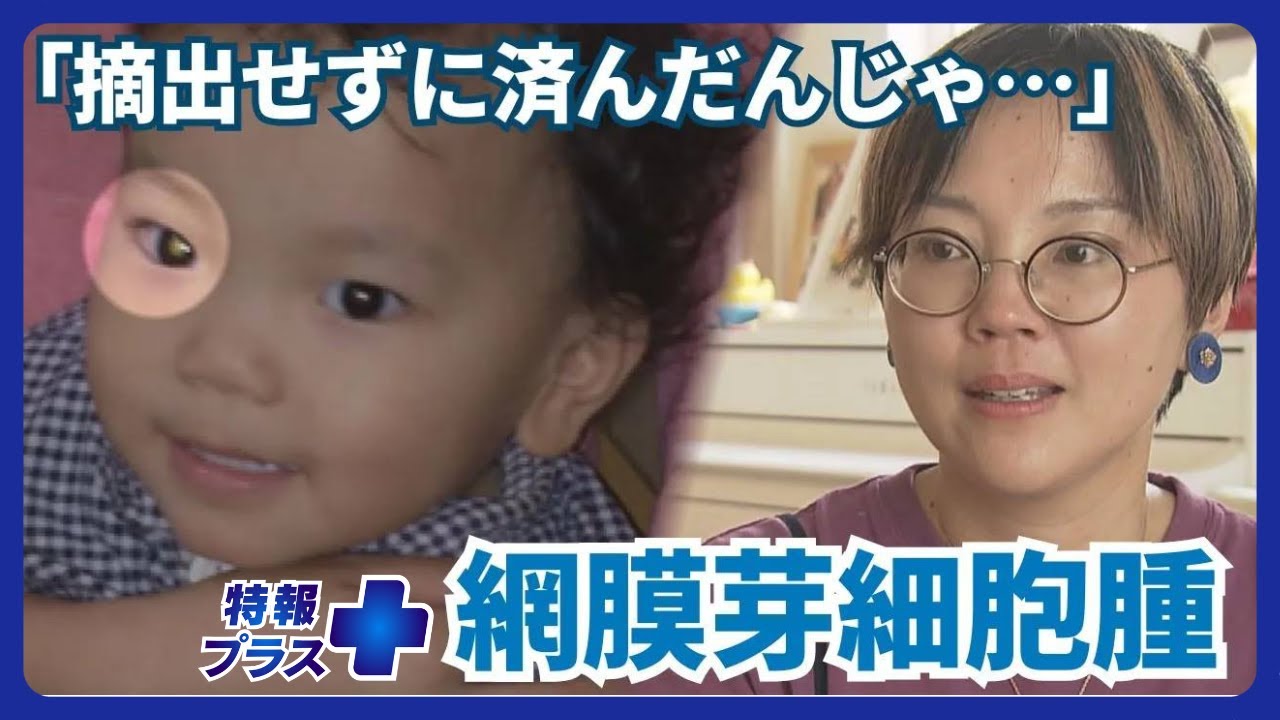 「早期発見できていれば…」希少な小児がん『網膜芽細胞腫』 母親の“後悔と決意”【特報プラス】