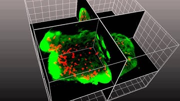 Ortho & Oblique Slicers
