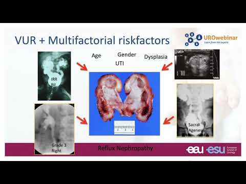 Urowebinar: Practical approach to paediatric urology