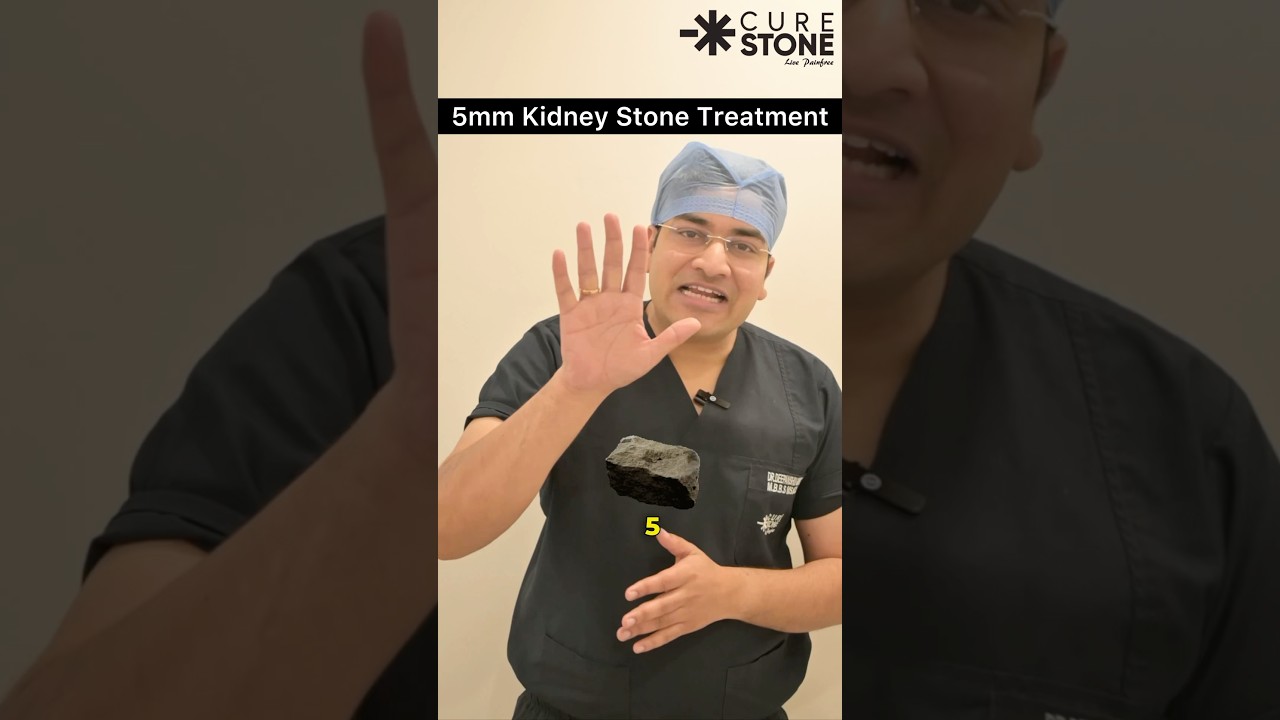 5mm Kidney Stone Treatment | RIRS | fans rirs | Kidney stone laser | when to remove 5 mm stone