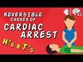YOUR PATIENT is STILL CODING, NOW WHAT?! - Reversible Causes of Cardiac Arrest - The H's and T's
