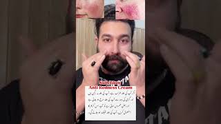 Skin Glow Anti Redness Cream Restore Skin Barrier spider veins