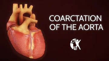 Dove nasce l'arteria aorta?
